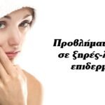 Προβλήματα ακμής σε ξηρές-λιπαρές επιδερμίδες