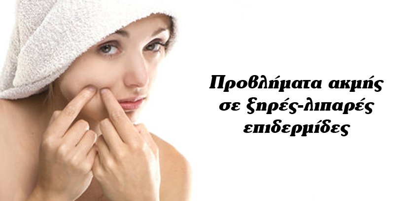 Προβλήματα ακμής σε ξηρές-λιπαρές επιδερμίδες