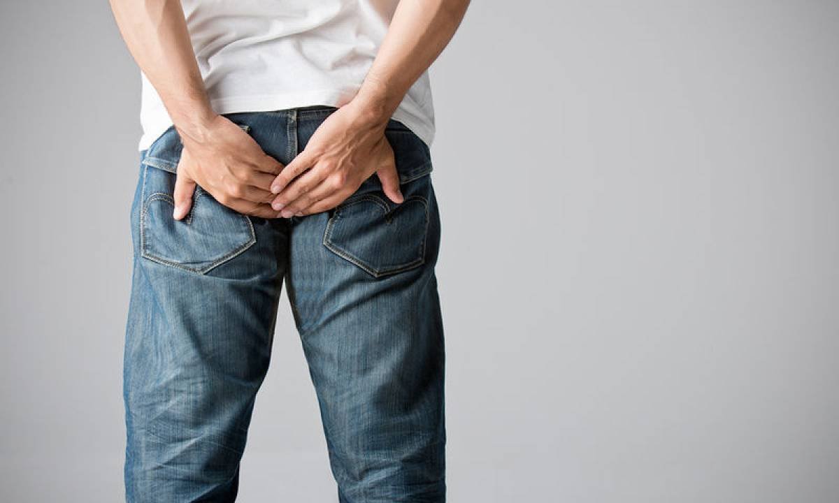 Κύστη Κόκκυγα – Συρίγγια