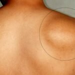 Η έκθεση στην υπεριώδη ακτινοβολία στους ναυτικούς και το μάθημα από το Kriti Ruby