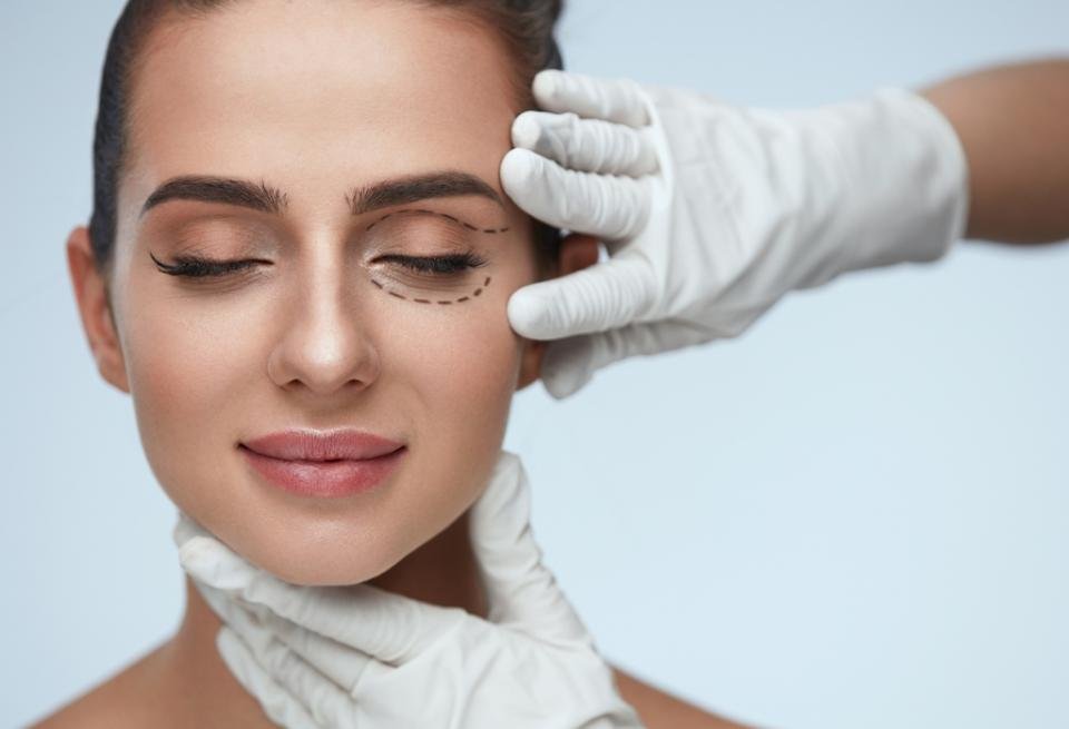 Βλεφαροπλαστική