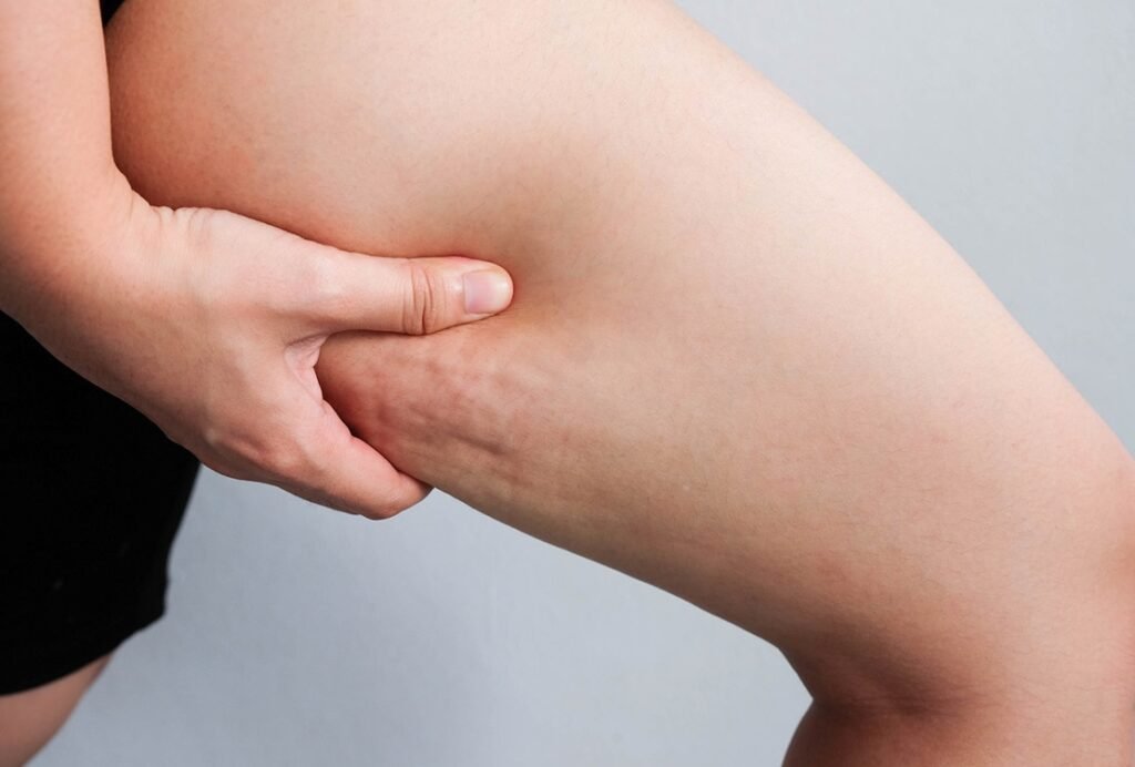 Θερμολιπόλυση