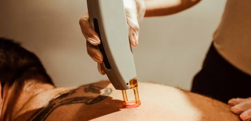 Αποτρίχωση Άνδρας