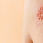 Από τη θάλασσα στην επιστήμη: το Kriti Ruby και η νέα εποχή της δερματολογικής πρόληψης