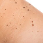 Η πρόληψη σώζει — στη θάλασσα και στο δέρμα μας