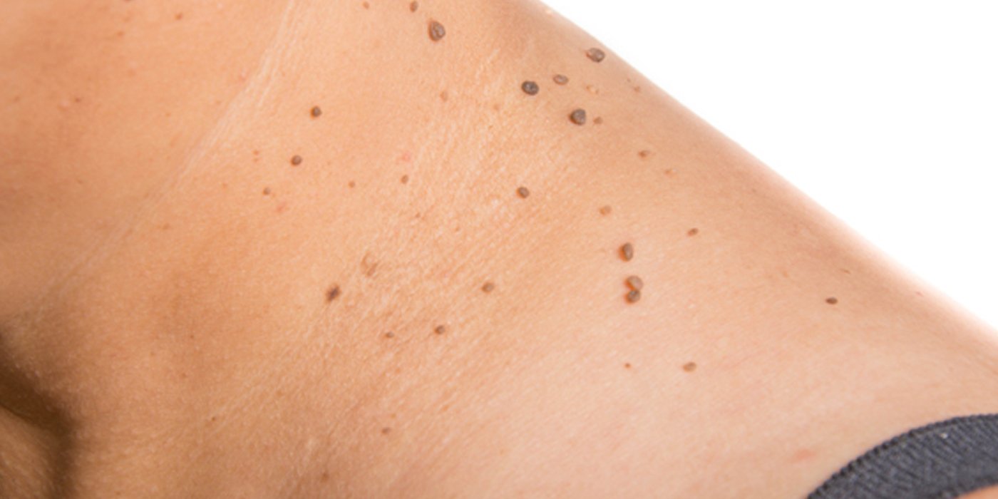 Η πρόληψη σώζει — στη θάλασσα και στο δέρμα μας