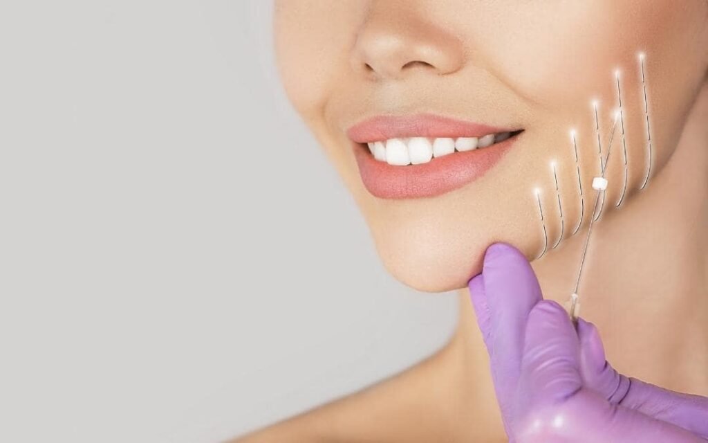 Lifting νημάτων