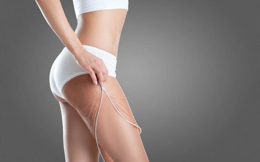 Κυτταρίτιδα