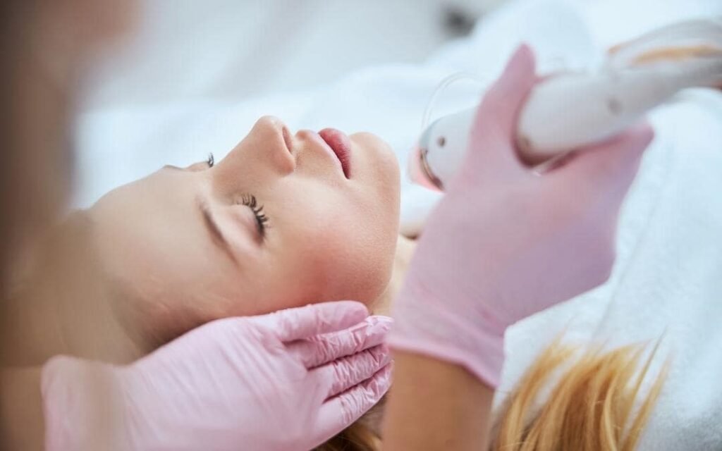 RF Fractional Microneedling