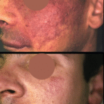 Kriti Ruby: When Science Sails Beyond the Horizon — A New Era in Dermatological Prevention